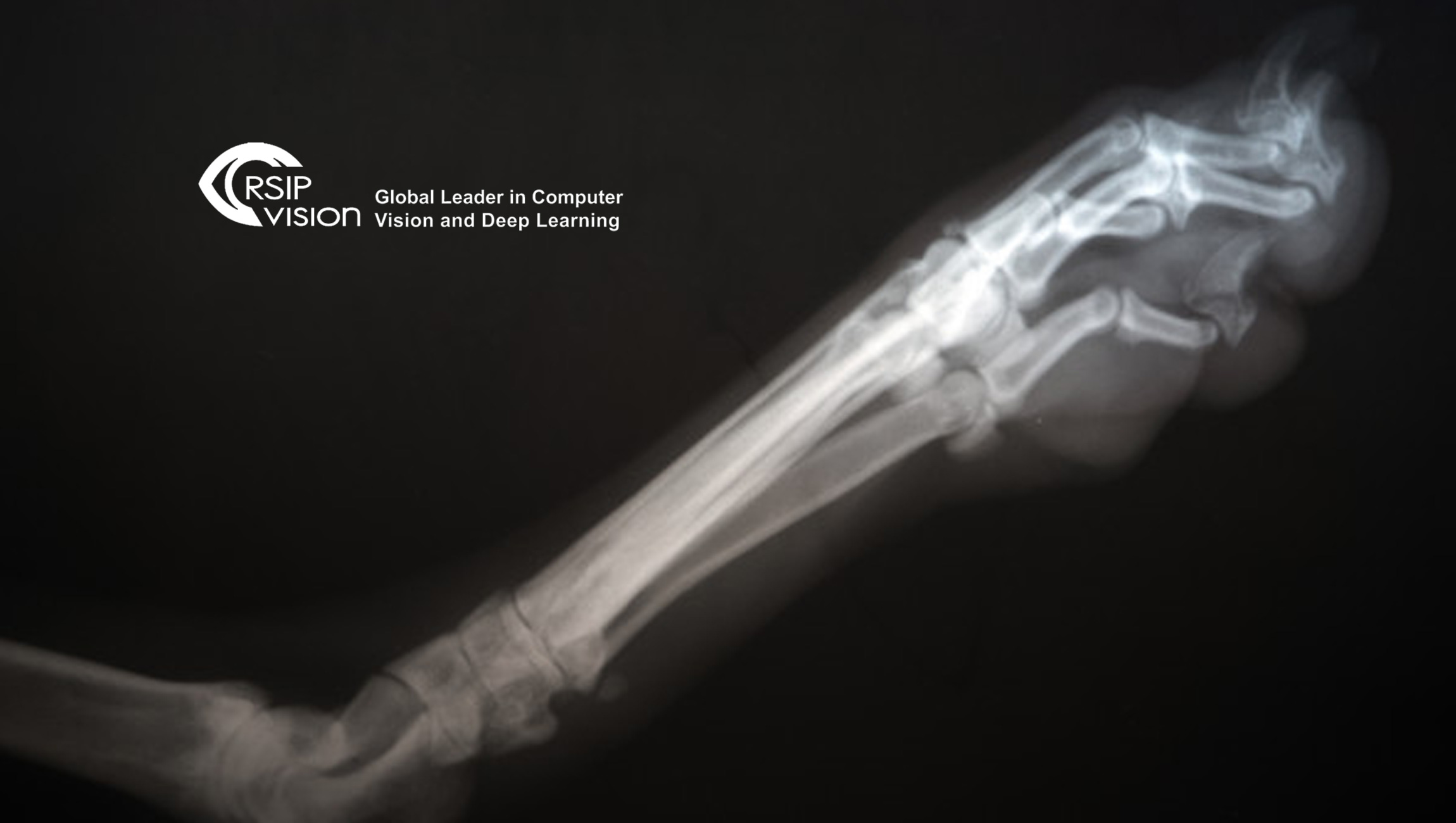 RSIP Vision Announces Breakthrough AI technology for 3D Reconstruction of Knees from X-ray Images