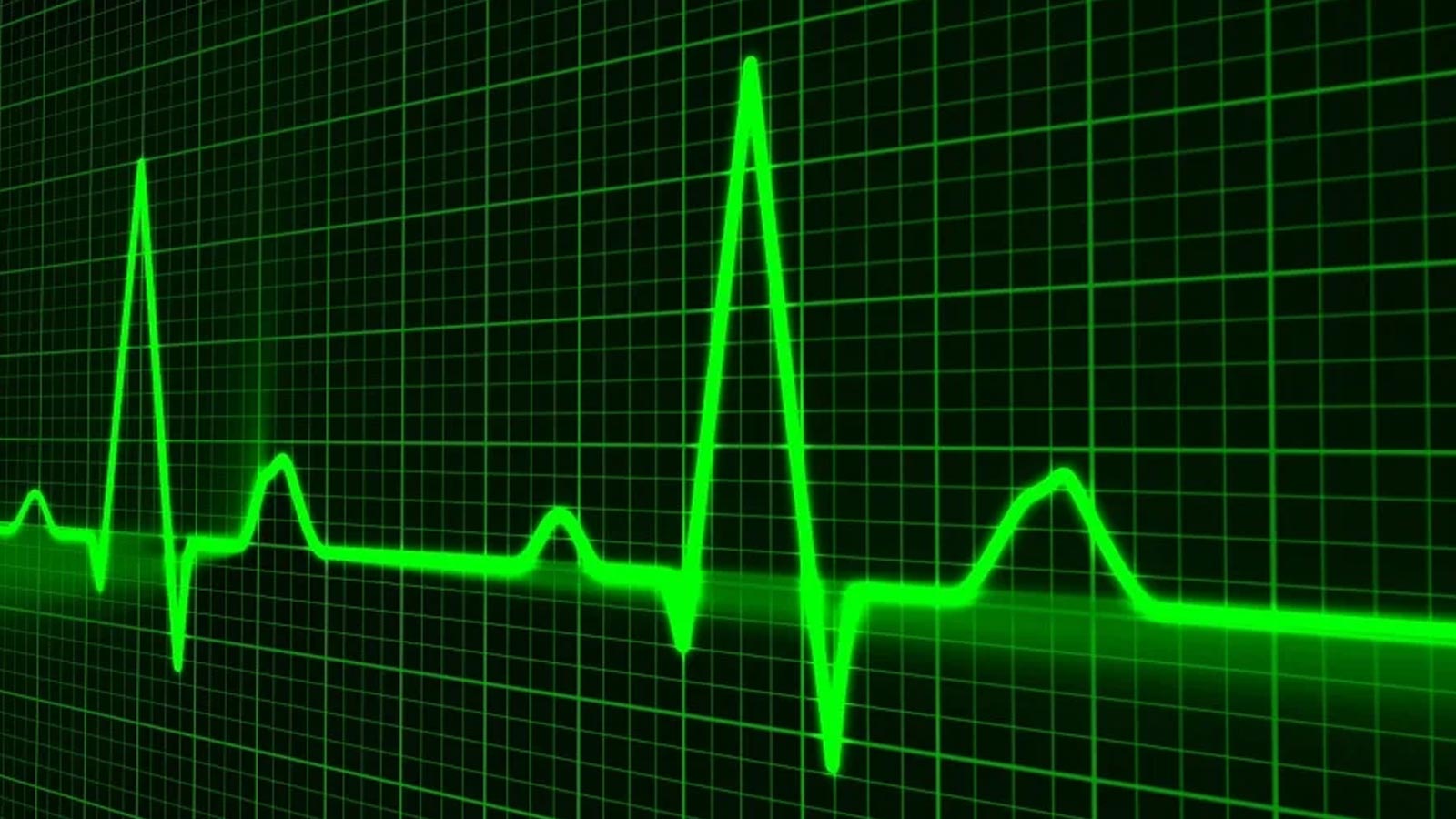 iFit Introduces Fitness Breakthrough: Personalized and Automatic Heart Rate Training with iFit ActivePulse