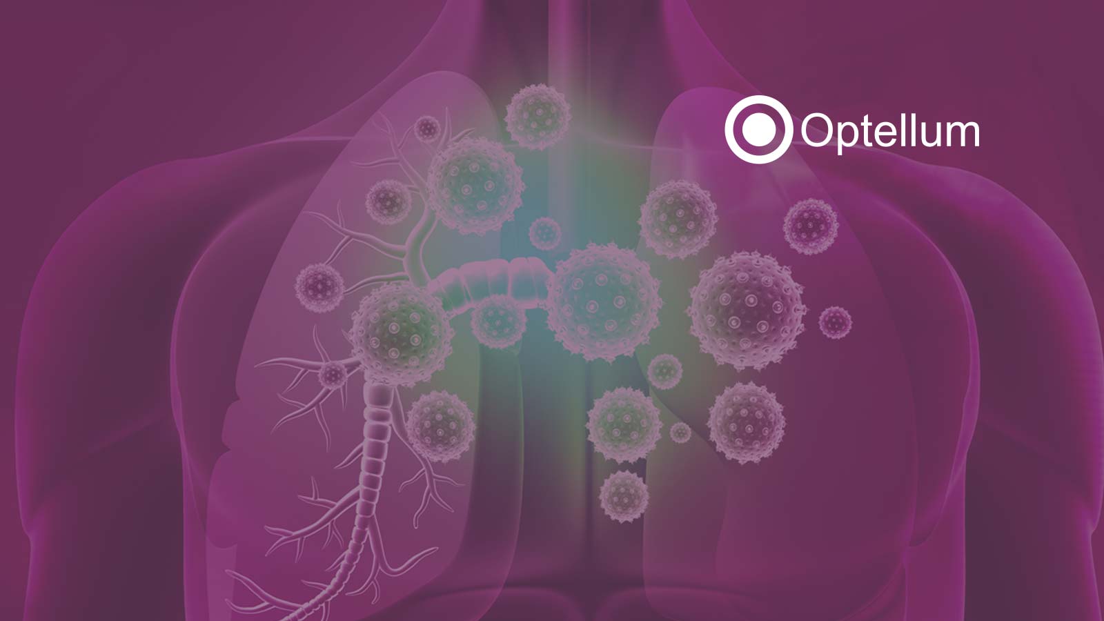 UK Health Tech Company, Goes Global With Breakthrough in Early Lung Cancer Diagnosis AI Technology