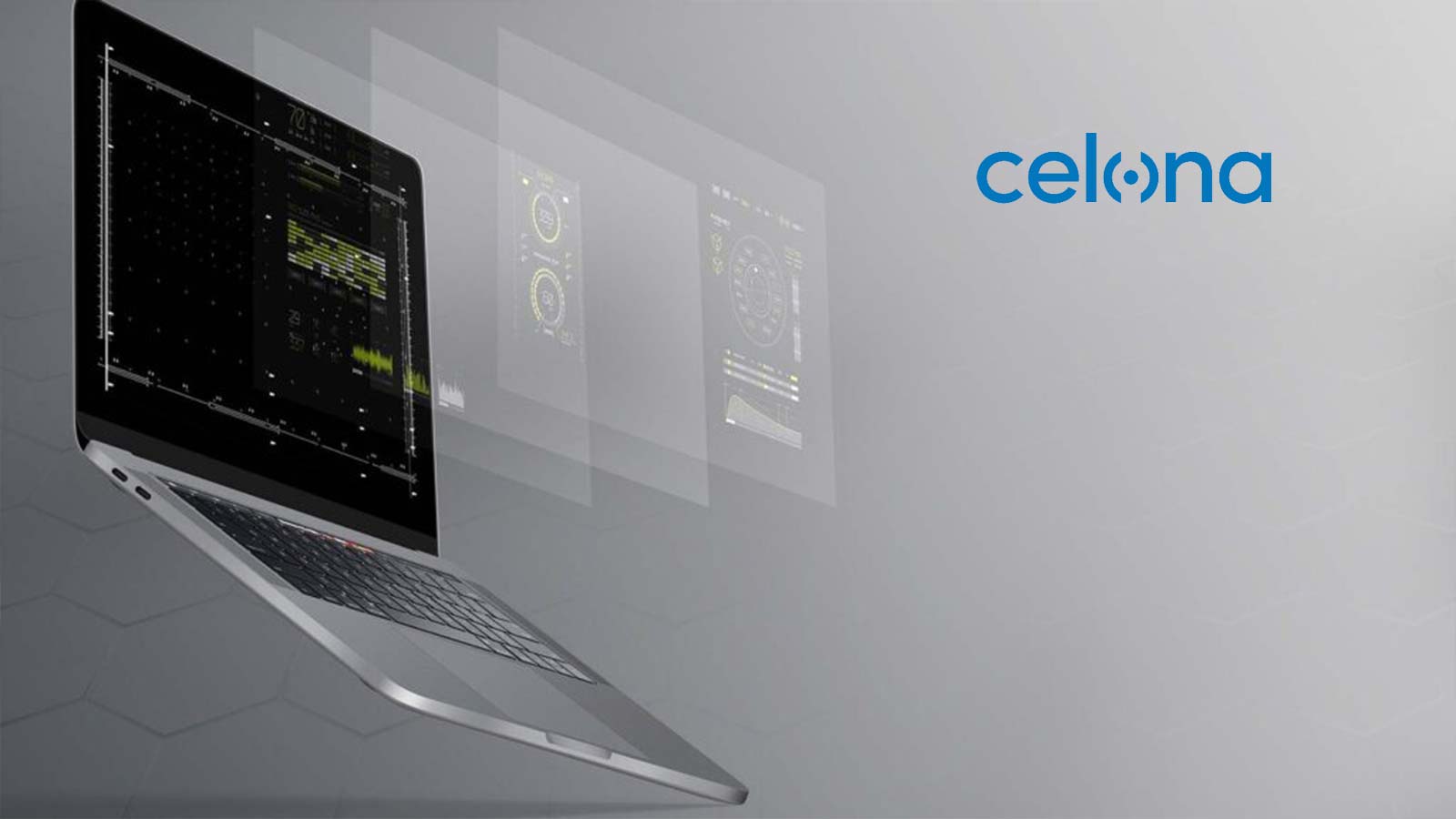 Celona Introduces Industry’s First Enterprise Open RAN Technology to Help Accelerate the Smooth Transition to Interoperable Networks