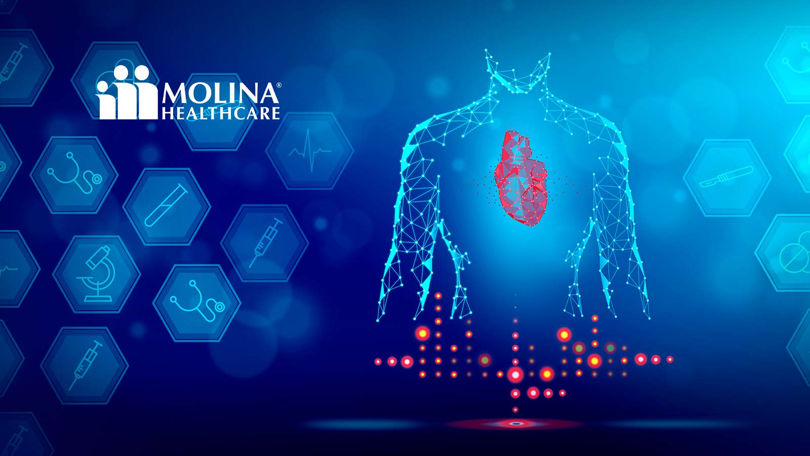 Molina Healthcare Announces Proposed Offering of $750 Million Of Senior Notes Due 2032