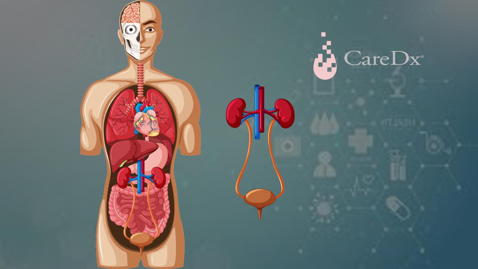 CareDx Announces Cibiltech Initiates CIBIL Study Using iBox Artificial Intelligence to Monitor Kidney Transplant Patients