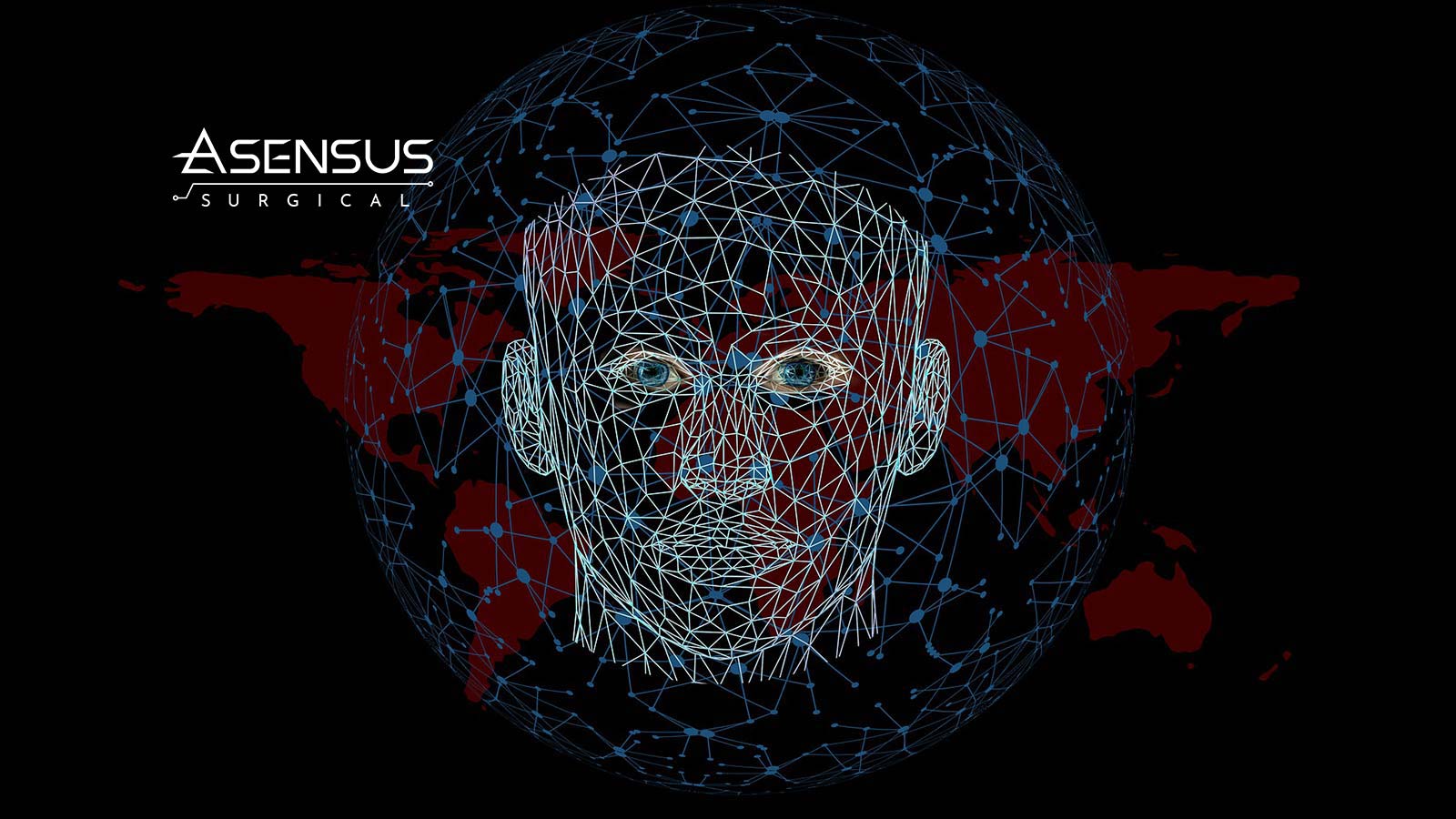 Asensus Surgical Announces Sale of Senhance Robotic System