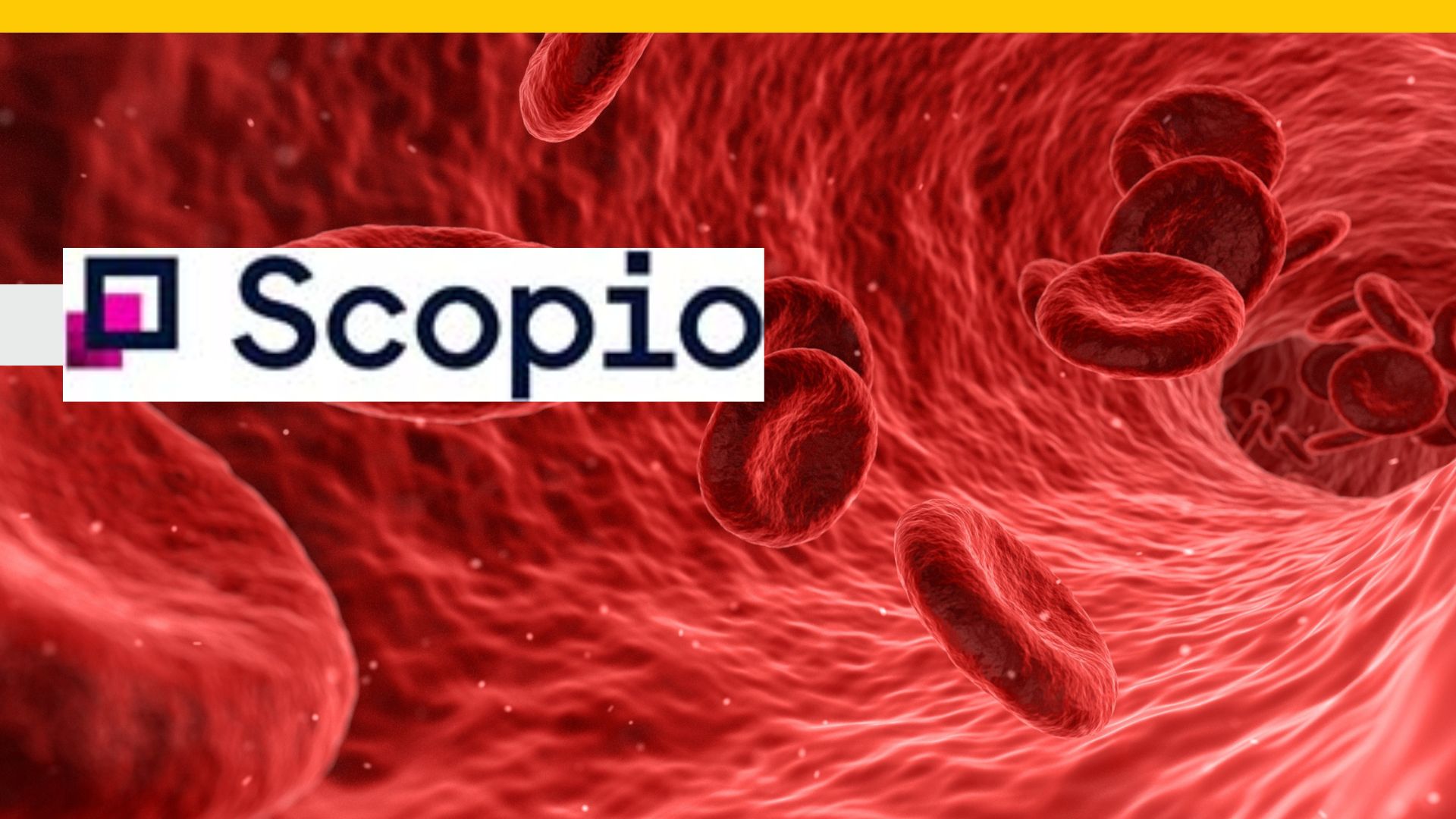 AI-Based Hematopathology Platform Accelerates Bone and Blood Cancer Detection