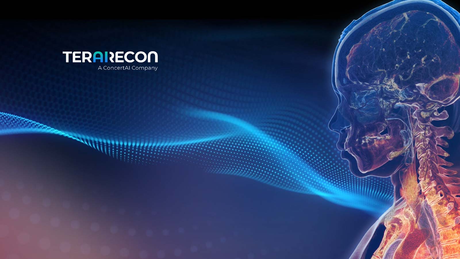 TeraRecon Announces Launch of its Next Generation Eureka Clinical AI Platform