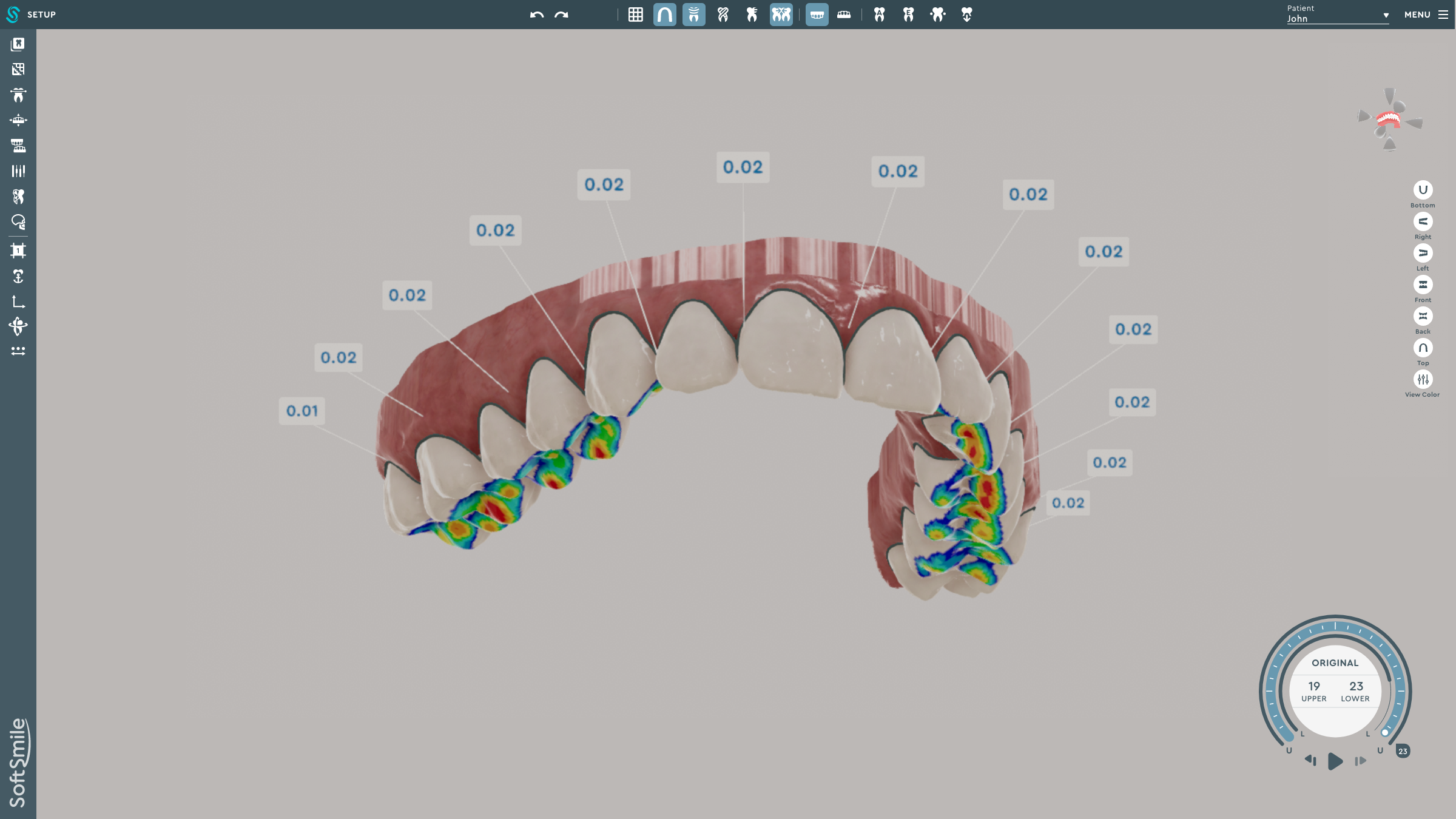 Three Ways AI-Driven Technology is Advancing Orthodontic Treatment and Improving Patient Outcomes