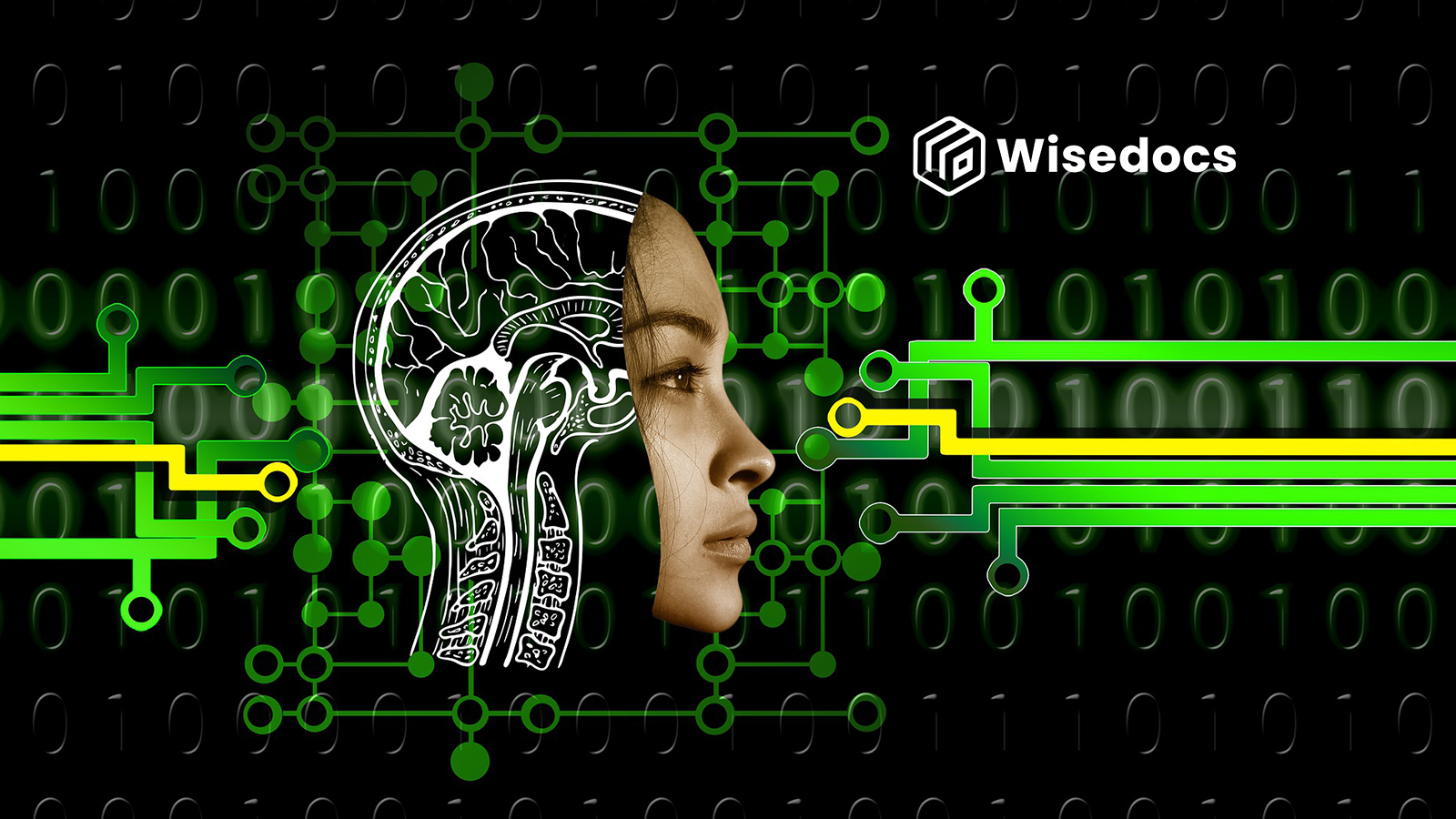 Wisedocs Launches Medical Record Summary Platform Powered by State-of-the-Art Generative AI