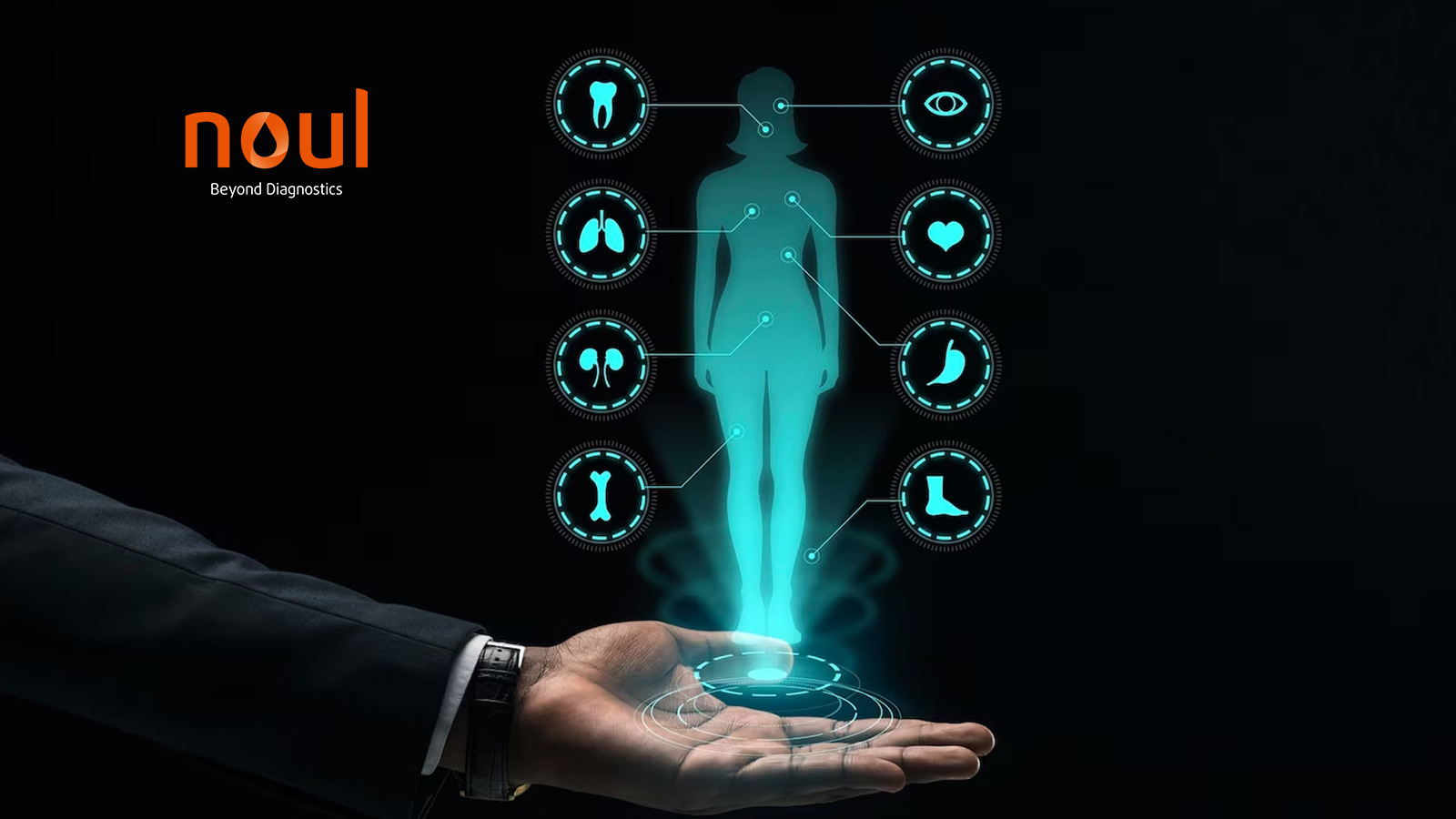 Noul Becomes First Korean Diagnostic Company to Join Swiss Malaria Group